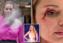 New Zealand reporter bloodied by flying bird in the middle of news segment