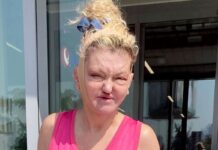 EastEnders’ Danniella Westbrook reveals dramatic new face after reconstructive surgery