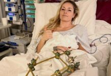 Lindsey Vonn says surgery saved leg from amputation after Olympics crash