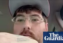 US man issues challenge to disprove his claim of having world’s smallest penis to raise micropenis awareness