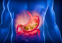 Acid reflux sufferers urged to avoid major ‘error’ when taking medication