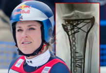 Lindsey Vonn ‘Struggling’ After Last Surgery, Remains Hospitalized in U.S.
