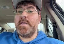 Man Who Claims to Have World’s Smallest Penis Happy to Accept Challengers