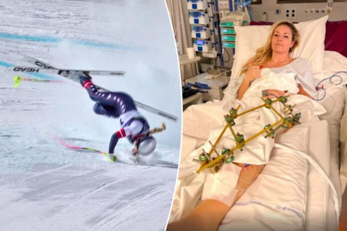 lindsey-vonn-surgeries.jpg