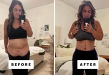 I Got Skin Removal Surgery After Losing 230 Pounds On a GLP-1