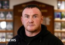 My shirt was soaked in blood – but I was told to get back on the rugby pitch