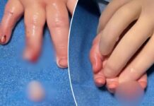 Baby’s finger allegedly severed at day care center