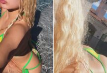 Cheek of the Week — Guess Whose Stringy Bikini!