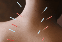 Acupuncture taught me that my shoulders are connected to my gut