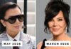 Is Kris Jenner’s Facelift Really Already “Slipping”?