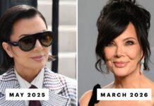 Is Kris Jenner’s Facelift Really Already “Slipping”?