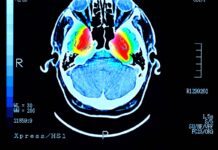 Popular holiday drink could raise dementia risk – even modest amounts