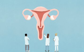 Why has polycystic ovary syndrome been renamed to PMOS and what it means for sufferers?