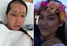 Tourist’s trip turns into a nightmare after simple act of kindness leaves her in the ICU