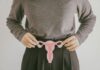 6 early signs of PCOS that are often overlooked as condition gets new name