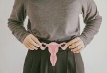 6 early signs of PCOS that are often overlooked as condition gets new name