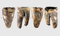 Tooth From Siberian Cave Reveals Neanderthal Dental Surgery