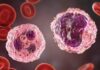 Kerala Reports Another Death Due to Brain-Eating Amoeba
