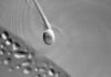 Anti-Aging Millionaire Announces He Has Split Back Into Sperm And Egg