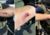 Anti-ICE agitator charged with allegedly biting officers during Delaney Hall clashes