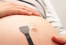 Wearable ultrasound patch can monitor high-risk pregnancies round the clock