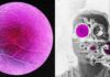Longevity Startup Doses First Human in Bid to Reverse Age-Related Sight Loss