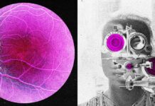 Longevity Startup Doses First Human in Bid to Reverse Age-Related Sight Loss