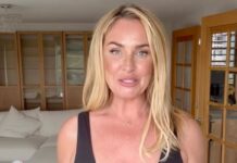 This Morning’s Josie Gibson shows scars after arm lift surgery