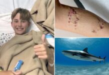 Boy, 12, believed he was going ‘to die’ after grisly shark attack on Bahamas family vacation