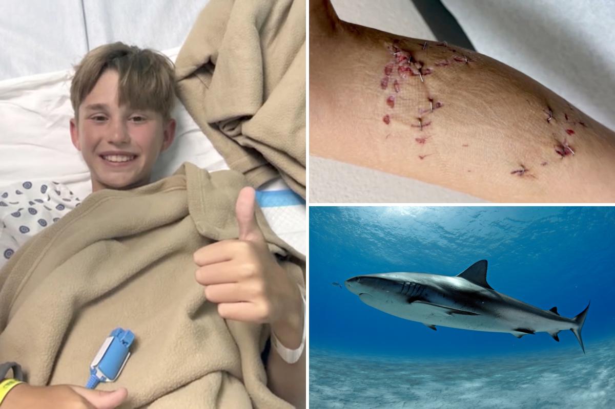 Boy, 12, believed he was going ‘to die’ after grisly shark attack on Bahamas family vacation