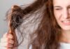 Going Bald at 25