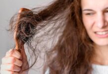 Going Bald at 25