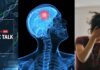 ABP Live Doc Talk | Think All Brain Tumours Are Cancerous? 5 Myths Debunked