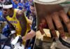 Lakers’ Jarred Vanderbilt shares graphic photos of gruesome finger injury: ‘Looks like a chicken wing’