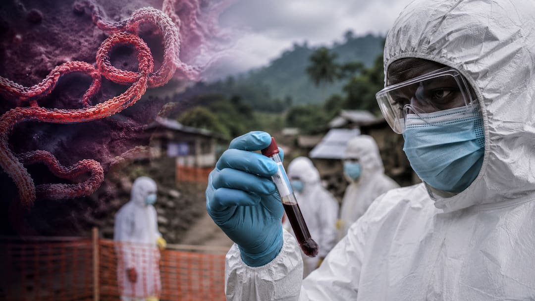 Ebola Outbreak 2026: Congo Reports Over 2,000 Deaths As Virus Spreads, Know Symptoms And Risks