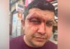 Gang of men hurl racist abuse at takeaway owner before violent attack
