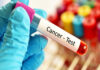 Health ministry to streamline cancer care through national network