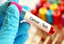 Health ministry to streamline cancer care through national network