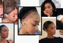 More Women Are Getting Hair Transplants in Turkey