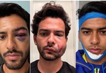 From Century To Horror Injury In 24 Hours: Fomer India Star Shares Update | WATCH