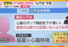 World’s First iPS Cell Heart Surgery Performed in Osaka
