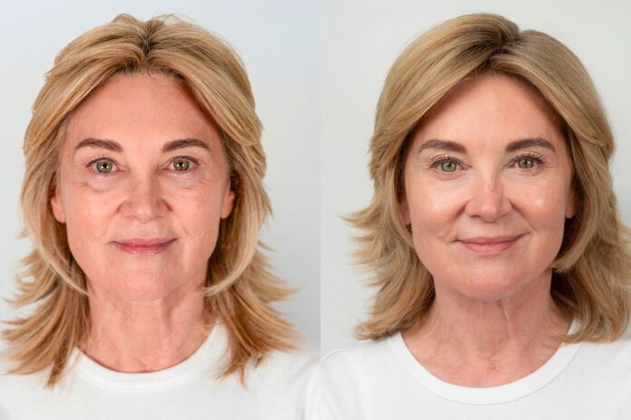 0_Anthea-Turner-BEFORE-and-AFTER-Full-Frontal-without-text.jpg
