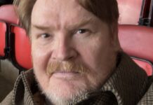 Actor realised he needed scooter after role in Gregg Davies comedy
