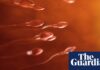 Teenager becomes first person to have testicular tissue transplant in UK