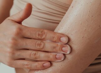 10 Beauty Products and Treatments That Can Trigger a Psoriasis Flare